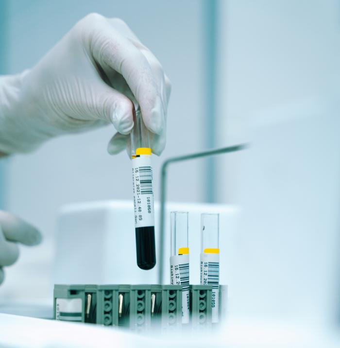 ISO 15189:2022 Laboratory Qualification